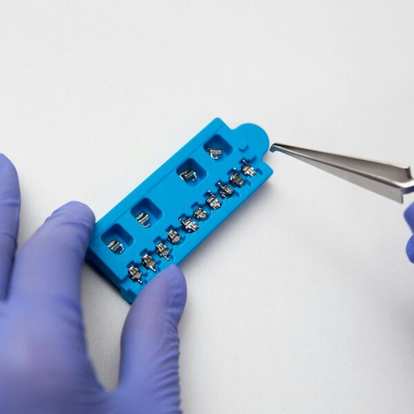 Extracția dentară: când e ultima soluție